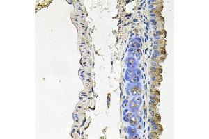 Immunohistochemistry of paraffin-embedded mouse lung using NDUFA6 antibody at dilution of 1:100 (x40 lens). (NDUFA6 antibody)