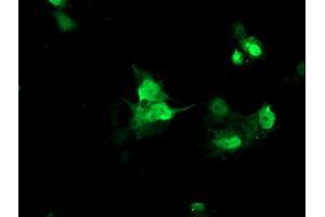 Image no. 2 for anti-Family With Sequence Similarity 119A (FAM119A) antibody (ABIN1498598) (FAM119A antibody)