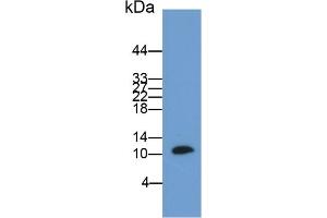 Detection of S100B in Rat Cerebrum lysate using Polyclonal Antibody to S100 Calcium Binding Protein B (S100B) (S100B antibody  (AA 1-92))