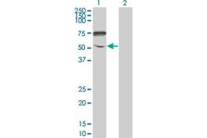Western Blot analysis of ENPP5 expression in transfected 293T cell line by ENPP5 monoclonal antibody (M01), clone 1C5-1D7. (ENPP5 antibody  (AA 24-477))