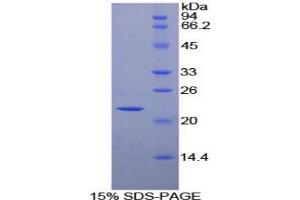 SDS-PAGE analysis of Mouse HSPb2 Protein.