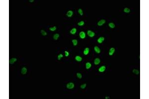Immunofluorescence staining of Hela cells with ABIN7127720 at 1:100,counter-stained with DAPI. (Recombinant NRF2 antibody  (pSer40))