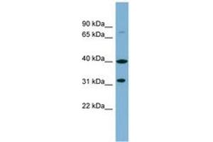 Image no. 1 for anti-Ferric-Chelate Reductase 1 Like (FRRS1L) (AA 215-264) antibody (ABIN6742026) (Ferric-Chelate Reductase 1 Like (FRRS1L) (AA 215-264) antibody)