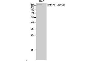 Western Blotting (WB) image for anti-Epidermal Growth Factor Receptor (EGFR) (pTyr1016) antibody (ABIN3182754) (EGFR antibody  (pTyr1016))