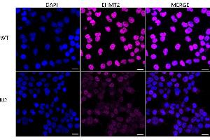 Immunocytochemical staining of HeLa cells using EHMT2 antibody (ABIN7797609), 1:1,000), Top panel: wild-type (WT), Bottom panal: EHMT2 shRNA knockdown (KD).