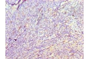 Immunohistochemistry of paraffin-embedded human tonsil tissue using ABIN7149566 at dilution of 1:100 (DIDO1 antibody  (AA 1-300))