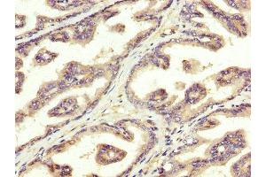 IHC image of ABIN7170778 diluted at 1:300 and staining in paraffin-embedded human prostate tissue performed on a Leica BondTM system. (SREBF1 antibody  (AA 38-201))