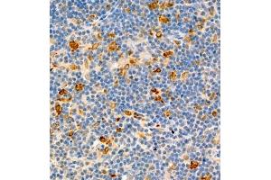 Immunohistochemistry of paraffin embedded rat thymus using MHC-II (ABIN7074245) at dilution of 1:1800 (400x lens) (CD74 antibody)