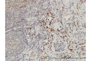 Immunoperoxidase of monoclonal antibody to CSE1L on formalin-fixed paraffin-embedded human tonsil. (Exportin 2 antibody  (AA 872-971))
