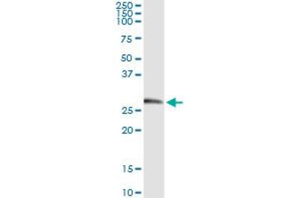Kallikrein 2 antibody  (AA 1-262)