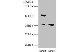 Western blot All lanes: IMPACT antibody at 10 μg/mL Lane 1: Hela whole cell lysate Lane 2: HL60 whole cell lysate Secondary Goat polyclonal to rabbit IgG at 1/10000 dilution Predicted band size: 37, 23 kDa Observed band size: 37, 52 kDa (IMPACT antibody  (AA 41-320))