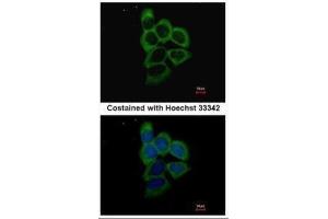 ICC/IF Image Immunofluorescence analysis of methanol-fixed A431, using PSMD2, antibody at 1:500 dilution. (PSMD2 antibody)