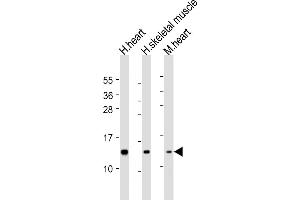 All lanes : Anti-NDUFS6 Antibody (Center) at 1:2000 dilution Lane 1: human heart lysate Lane 2: human skeletal muscle lysate Lane 3: mouse heart lysate Lysates/proteins at 20 μg per lane.