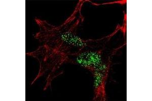 Fluorescent confocal image of SY5Y cells stained with KLF4 antibody at 1:100.