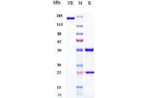 Anti-LOXL2 Reference Antibody (simtuzumab) on SDS-PAGE under reducing (R) condition. (Recombinant LOXL2 (Simtuzumab Biosimilar) antibody)