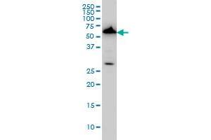 AAAS monoclonal antibody (M02), clone 5A1 Western Blot analysis of AAAS expression in HeLa (ABIN1339522). (Adracalin antibody  (AA 1-100))