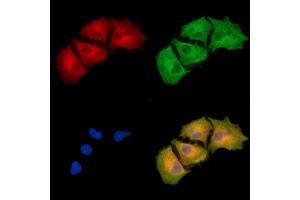 ABIN6260907 and ABIN6279340 staining  cells by IF/ICC.