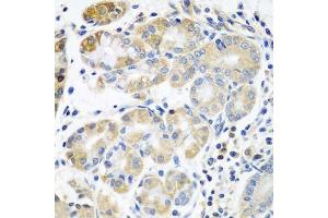 Immunohistochemistry of paraffin-embedded human stomach using PLS3 antibody. (Plastin 3 antibody  (AA 1-240))