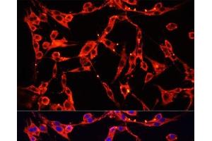 Immunofluorescence analysis of PC-12 cells using AOC1 Polyclonal Antibody at dilution of 1:100 (40x lens). (DAO antibody)