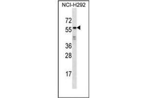 Western blot analysis of ODF2L Antibody (C-term) in NCI-H292 cell line lysates (35ug/lane). (ODF2L antibody  (C-Term))