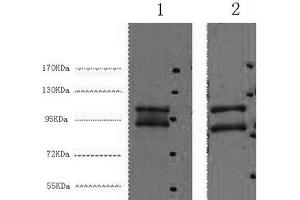 Western Blot analysis of 1) Hela, 2) HepG2 cells using IDE Monoclonal Antibody at dilution of 1:2000.