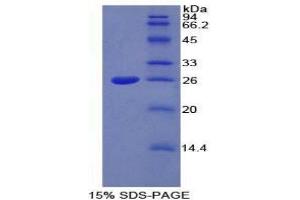 SDS-PAGE (SDS) image for Ceruloplasmin (Ferroxidase) (CP) (AA 872-1059) protein (His tag) (ABIN2124305)