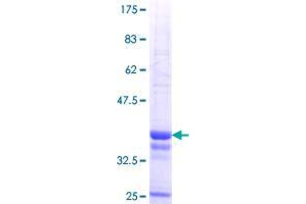 ATP8B4 Protein (AA 401-488) (GST tag)