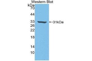 Western Blotting (WB) image for anti-rho-Associated, Coiled-Coil Containing Protein Kinase 2 (ROCK2) (AA 904-1140) antibody (ABIN3205961) (ROCK2 antibody  (AA 904-1140))