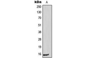 Western blot analysis of PIG11 expression in HuvEc (A) whole cell lysates. (TP53I11 antibody  (Center))