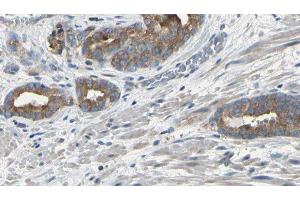 ABIN6275121 at 1/100 staining Human prostate tissue by IHC-P. (EIF3F antibody  (Internal Region))