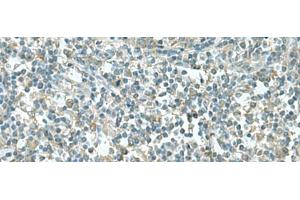 Immunohistochemistry of paraffin-embedded Human tonsil tissue using CCT5 Polyclonal Antibody at dilution of 1:55(x200) (CCT5 antibody)