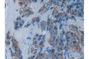 Immunohistochemistry (IHC) image for anti-Eukaryotic Translation Initiation Factor 2-alpha Kinase 2 (EIF2AK2) (AA 224-502) antibody (ABIN7431893)
