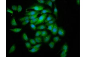 Immunofluorescence staining of A549 cells with ABIN7153444 at 1:133, counter-stained with DAPI. (Galectin 10 antibody  (AA 2-142))