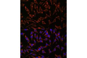 Immunofluorescence (IF) image for anti-Septin 8 (SEPT8) (AA 348-427) antibody (ABIN7265350)