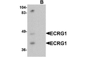 Western blot analysis of ECRG1 in mouse liver tissue lysate with ECRG1 antibody at 1 ug/mL in (A) the absence and (B) the presence of blocking peptide. (TMPRSS11A antibody  (C-Term))