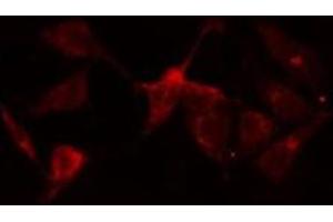 ABIN6275891 staining  HeLa cells by IF/ICC. (NR1I2 antibody  (Internal Region))