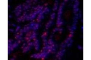 Immunofluorescence analysis of Rat lung tissue using SIRT1 Polyclonal Antibody at dilution of 1:200. (SIRT1 antibody)