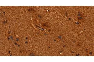 Immunohistochemistry of paraffin-embedded Human brain tissue using ALG11 Polyclonal Antibody at dilution 1:40 (ALG11 antibody)