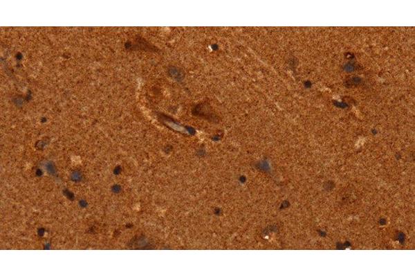 ALG11 antibody