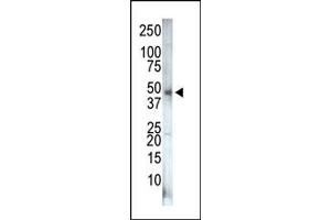 Image no. 1 for anti-Phosphatidylinositol-5-Phosphate 4-Kinase, Type II, gamma (PIP4K2C) (C-Term) antibody (ABIN360486) (PIP4K2C antibody  (C-Term))