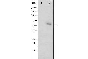 Western blot analysis of Dab1 phosphorylation expression in LOVO whole cell lysates,The lane on the left is treated with the antigen-specific peptide. (DAB1 antibody  (pTyr232))