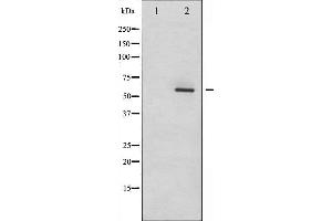 Western blot analysis of Dab1 phosphorylation expression in LOVO whole cell lysates,The lane on the left is treated with the antigen-specific peptide. (DAB1 antibody  (pTyr232))