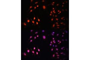 Immunofluorescence analysis of C6 cells using SETD2 Polyclonal Antibody (ABIN3017564, ABIN3017565, ABIN1682666 and ABIN6220156) at dilution of 1:100 (40x lens). (SETD2 antibody  (AA 803-1103))