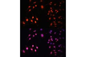 Immunofluorescence analysis of C6 cells using SETD2 Polyclonal Antibody (ABIN3017564, ABIN3017565, ABIN1682666 and ABIN6220156) at dilution of 1:100 (40x lens). (SETD2 antibody  (AA 803-1103))