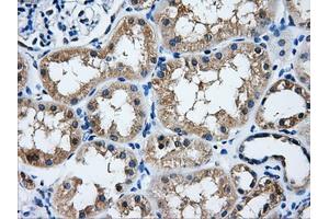 Immunohistochemical staining of paraffin-embedded liver tissue using anti-HDAC10mouse monoclonal antibody. (HDAC10 antibody)