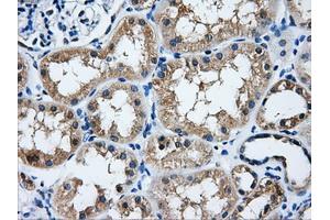 Immunohistochemical staining of paraffin-embedded liver tissue using anti-HDAC10mouse monoclonal antibody.