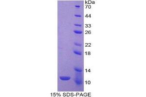 SDS-PAGE analysis of Rat IDO Protein.