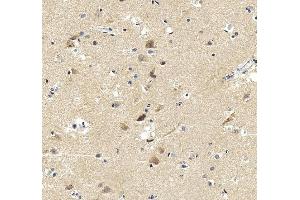 anti-Amyloid beta (A4) Precursor-Like Protein 1 (APLP1) (AA 82-112), (N-Term) antibody