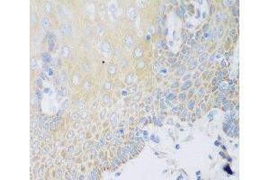 Immunohistochemistry of paraffin-embedded Human esophagus using DHODH Polyclonal Antibody at dilution of 1:100 (40x lens). (DHODH antibody)