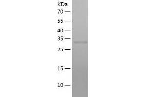 RBP3 Protein (AA 321-630) (His tag)